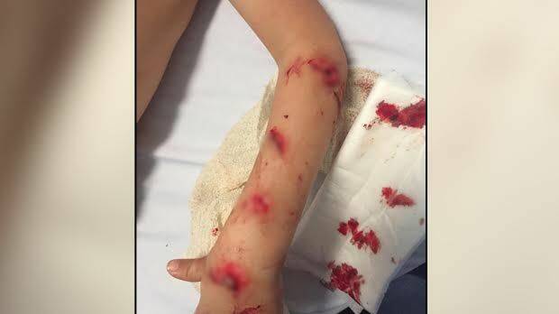 Cruz had several deep lacerations to his arms and body.  Photo: Supplied
