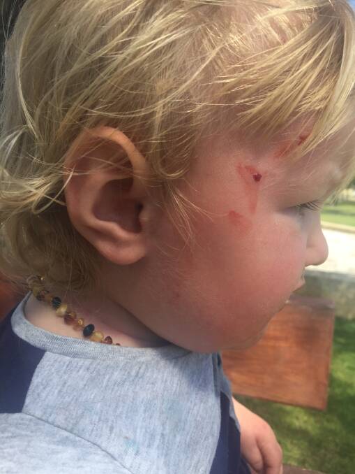Busselton toddler Jed Trevenen was injured after a magpie swooped him at a children's playground.