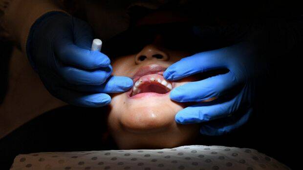 Dental conditions are the leading cause of preventable childhood hospital admissions in Victoria. Photo: Joe Armao